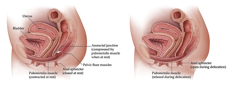 Treating Patients With Pelvic Floor Dysfunction For Medical 8801